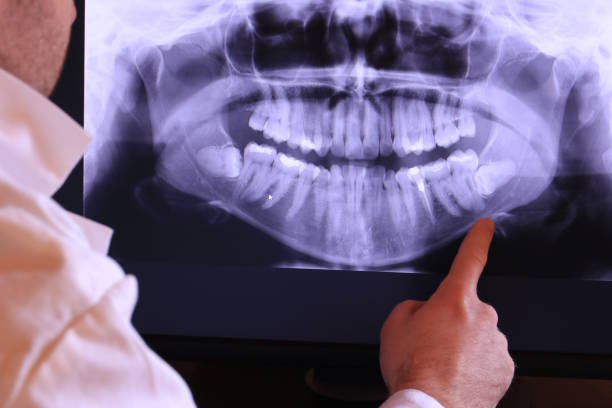 Best Emergency Dental Care for Broken or Chipped Teeth in Harlowton, MT